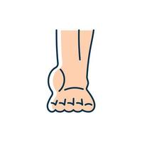 Ankle inflammation RGB color icon. Swollen foot and ankle. Osteoarthritis development. Soft-tissue injury. Sore ankle muscles. Tendonitis. Isolated vector illustration. Simple filled line drawing