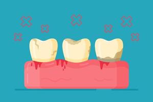 Vector illustration of dental diseases. Not hygienic. Going to the dentist.