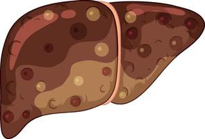 Fibrosis liver on white background vector