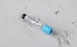 Coronavirus testing tube photo