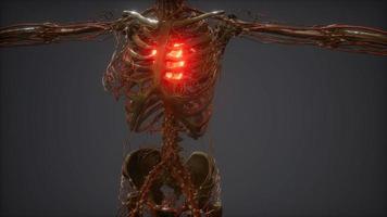 CG Animation Of A Sick Human Heart video