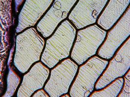 Onion epidermus micrograph photo