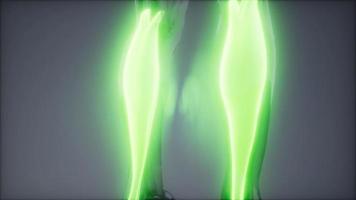 gastrocnemius- Visible muscle anatomy map video