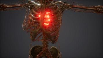 CG Animation Of A Sick Human Heart video