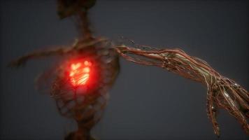 CG Animation Of A Sick Human Heart video