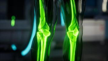 mänskliga skelett ben scan undersökning i lab video