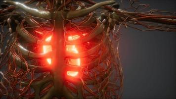 CG Animation Of A Sick Human Heart video