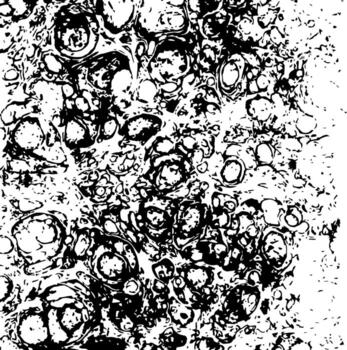 Rustic grunge vector texture with grain and stains. Abstract noise background. Weathered surface. Dirty and damaged.