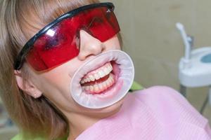 the woman on reception at the dentist , whitening of teeth and prevention photo