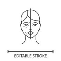 Before and after neurotoxin injection linear icon. Cosmetic procedure. Thin line illustration. Facial rejuvenation. Aesthetic medicine. Contour symbol. Vector isolated outline drawing. Editable stroke