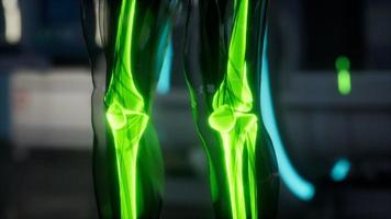 mänskliga skelett ben scan undersökning i lab video