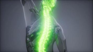 Backache in Back Bones video