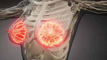 ilustración médica precisa de las glándulas mamarias de una mujer obesa video