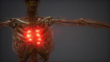 CG-Animation eines kranken menschlichen Herzens video