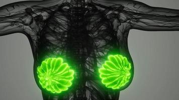 medical scan of Woman Breast Cancer video