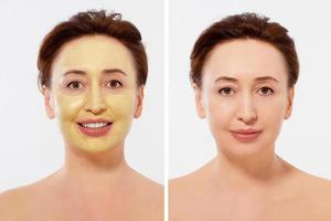 Middle age closeup woman face before after beauty mask treatment. Before-after wrinkled skin. Summer anti aging collagen mask on woman wrinkle face isolated. Mid aged facial skincare. Menopause period photo