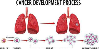 Infografía del proceso de desarrollo del cáncer. vector