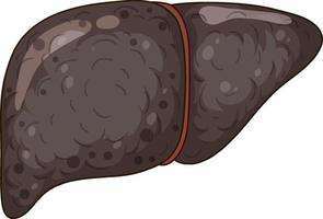 Cirrhosis liver on white background vector