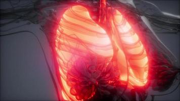 examen radiologique des poumons humains
