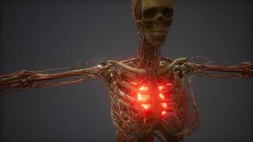 CG Animation Of A Sick Human Heart video