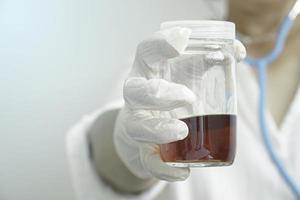 doctor in a white medical gown and white gloves holding a closed jar for medical tests with yellow urine. photo