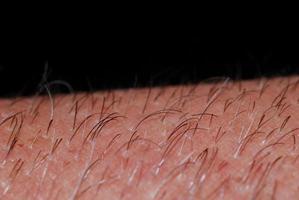 skin with hair in macro photo