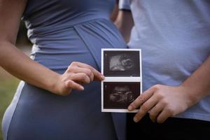 Pregnant Woman and Her Husband Holding an Ultrasound Image. Concept of Pregnancy, Healthcare, Gynecology, Medicine. Young Mother Expecting a Baby.