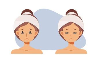 Skin care,beauty concept illustration. woman with dark circles on face. woman worried about dark circles.Flat vector cartoon character illustration.