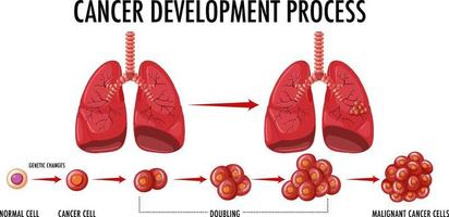 Cancer development process infographic vector