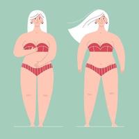 A beautiful plump woman in a swimsuit stands in full growth.One is ashamed of her body, the other is happy and loves hers.Concept of body positive,self love, overweight.Flat vector female character