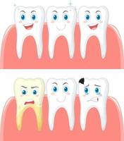 Set of strong teeth and tooth decay on white background vector