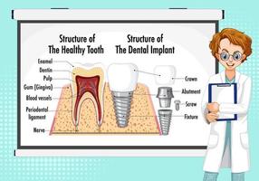 infografía de humanos en la estructura del diente sano vector