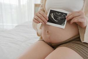 primer plano de una mujer embarazada que muestra una imagen de una ecografía del bebé en la barriga foto