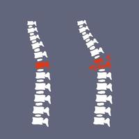 Problems with spine. Posture issues on blue background vector