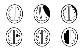 Infographic of Lesion or Pathology of CT Brain vector