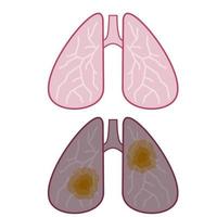 pulmón sucio con manchas marrones por fumar. el organo interno vector