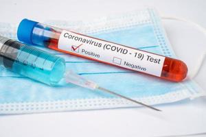 COVID19 virus or Coronavirus sample blood test tube in laboratory of hospital. photo