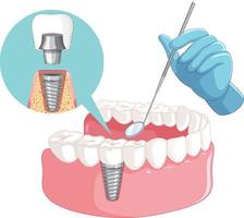 mano de dentista con modelo de dientes humanos vector