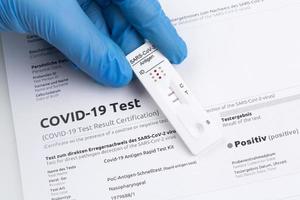 Positive test result by using rapid test device for COVID-19. photo