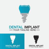 Dental implant logo vector  designs concept