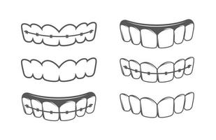 conjunto de dientes aislado sobre un fondo blanco vector