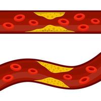 Blood cholesterol. Veins and arteries with fat. Problem with vascular system. vector