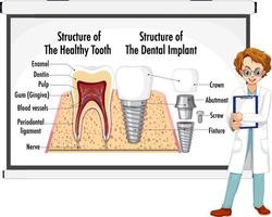 infografía de humanos en la estructura del diente sano vector