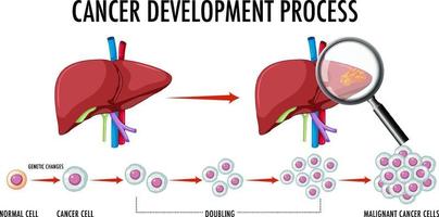 Diagram showing cancer development process vector