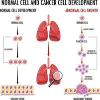diagrama que muestra células normales y cancerosas en humanos vector