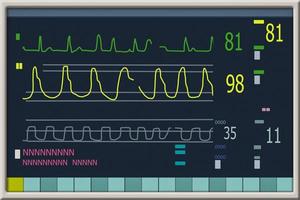 monitor de paciente que muestra signos vitales ecg y ekg. ilustración vectorial