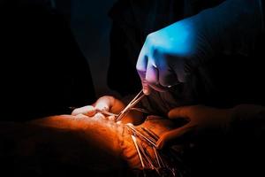 Pictures of surgery performed by a specialist surgeon. Color tones distinguish blue and orange. photo