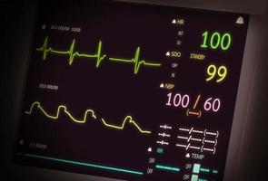 Patient monitor showing vital signs ECG and EKG. Vector illustration. photo