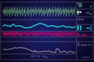 Patient monitor showing vital signs ECG and EKG. Vector illustration. photo