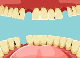 dientes humanos dentro de la boca con diente roto amarillo vector